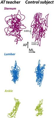 Altered coordination strategies during upright stance and gait in teachers of the Alexander Technique